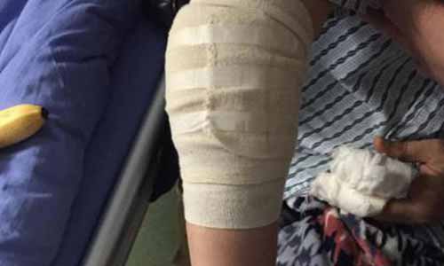 ֣��ʹ���ʪ��ҽԺ