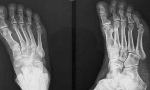 郑州痛风风湿病医院.jpg 郑州痛风风湿病医院