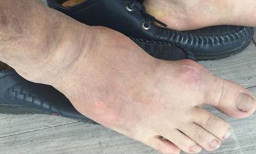 ֣��ʹ���ʪ��ҽԺ