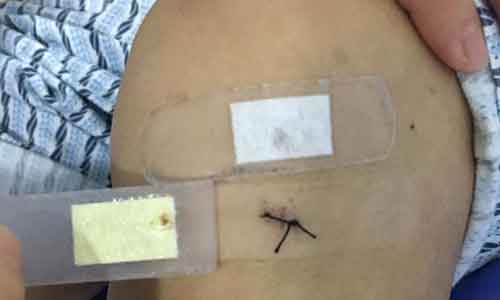 ֣��ʹ���ʪ��ҽԺ