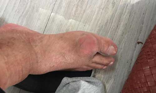 ֣��ʹ���ʪ��ҽԺ