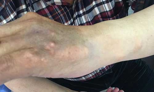 ֣��ʹ���ʪ��ҽԺ