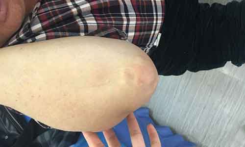 ֣��ʹ���ʪ��ҽԺ