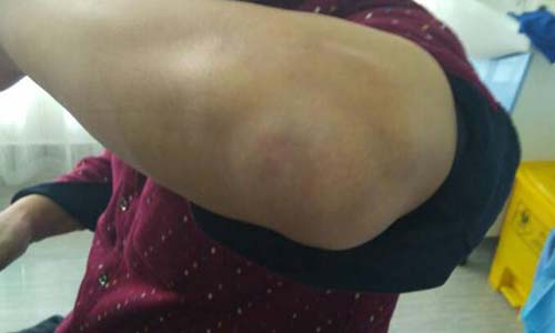 ֣��ʹ���ʪ��ҽԺ