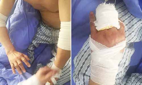 ֣��ʹ���ʪ��ҽԺ