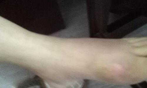 ֣��ʹ���ʪ��ҽԺ