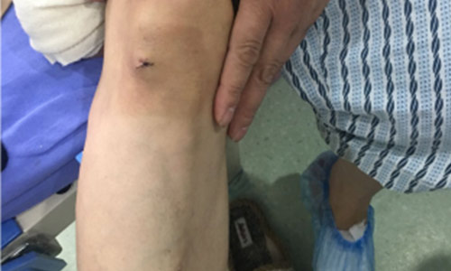 ֣��ʹ���ʪ��ҽԺ