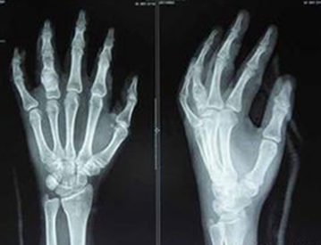 ֣��ʹ���ʪ��ҽԺ