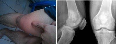 ֣��ʹ���ʪ��ҽԺ