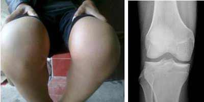 ֣��ʹ���ʪ��ҽԺ