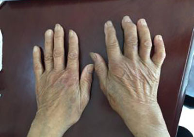 ֣��ʹ���ʪ��ҽԺ