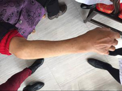 ֣��ʹ���ʪ��ҽԺ