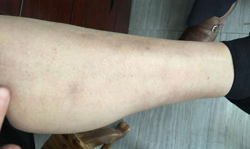 ֣��ʹ���ʪ��ҽԺ