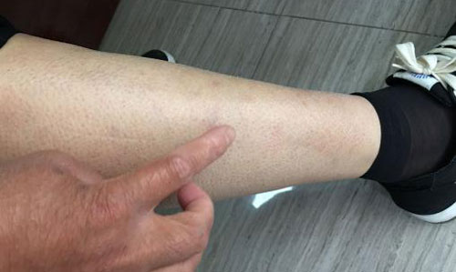 ֣��ʹ���ʪ��ҽԺ