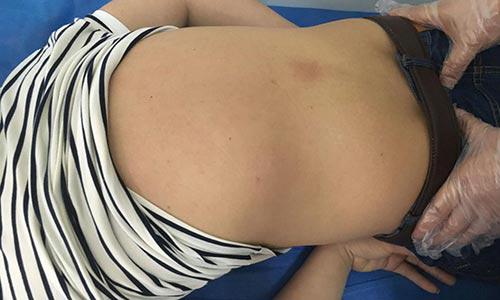 郑州痛风风湿病医院.jpg 郑州痛风风湿病医院