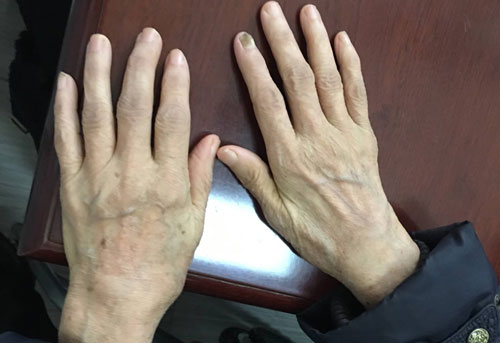 ֣��ʹ���ʪ��ҽԺ