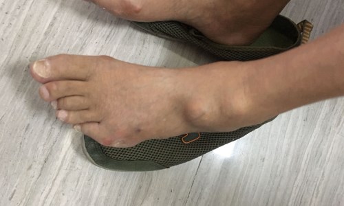 ֣��ʹ���ʪ��ҽԺ