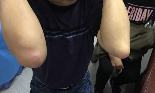 ֣��ʹ���ʪ��ҽԺ