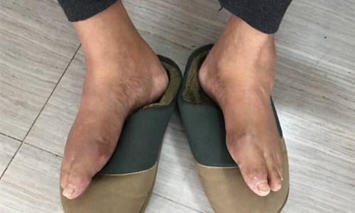 ֣��ʹ���ʪ��ҽԺ