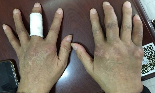 ֣��ʹ���ʪ��ҽԺ