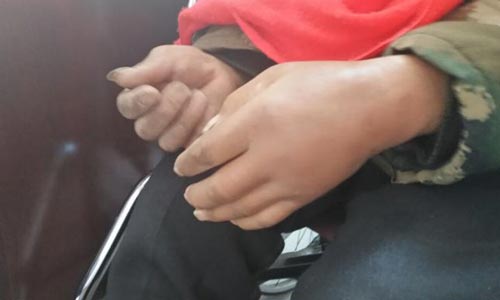 ֣��ʹ���ʪ��ҽԺ