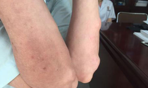 ֣��ʹ���ʪ��ҽԺ