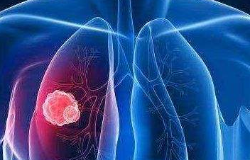 郑州内风湿医院 郑州内风湿医院.png