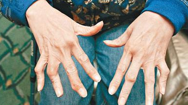 郑州风湿病专科医院 郑州风湿病专科医院.png