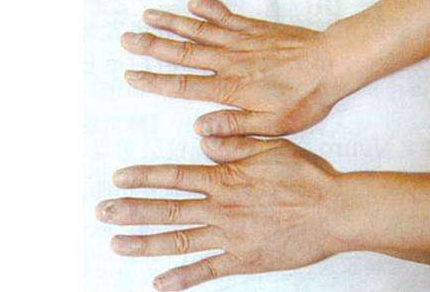 河南专业治风湿病医院 河南专业治风湿病医院.png