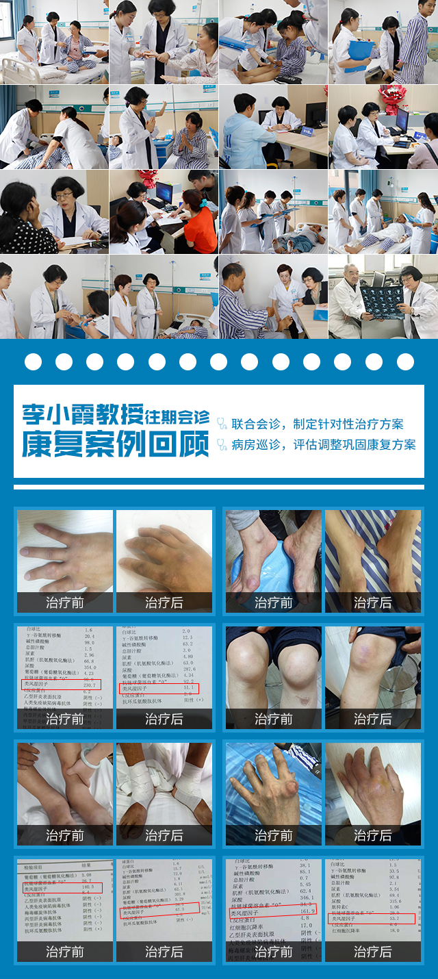 痛风风湿病专业抗复发科普知识公益讲座 痛风风湿病专业抗复发科普知识公益讲座