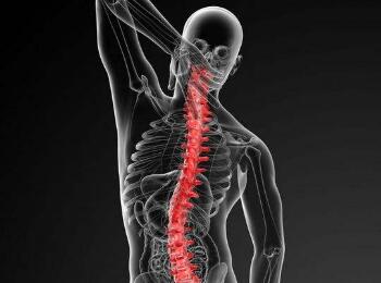 强直性脊柱炎早期症状是什么?强直性脊柱炎早期症状图片 郑州主治强直性脊柱炎医院.png