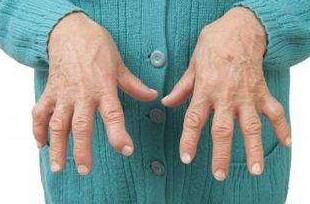 风湿病患者的饮食禁忌有哪些?郑州治风湿性关节炎医院 郑州治风湿性关节炎医院.png